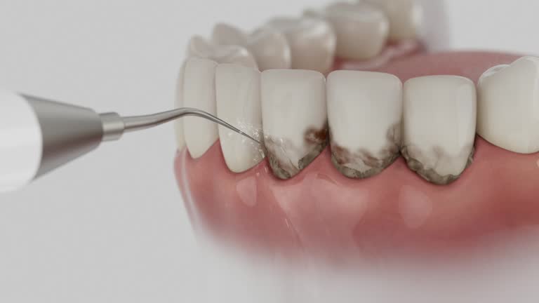 Reliable Dental contractor in Avon, IN by Dentist Open Now